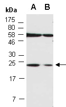PGRMC1 Antibody Western (Abiocode)
