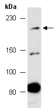 CDC42BPA Antibody Western (Abiocode)