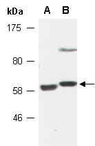 CDKN2AIP Antibody Western (Abiocode)