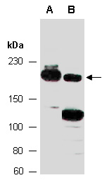 TICRR Antibody Western (Abiocode)