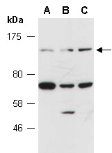 ZBTB10 Antibody Western (Abiocode)