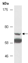 PRMT5 Antibody Western (Abiocode)