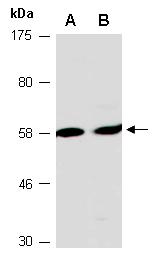 DCT Antibody Western (Abiocode)