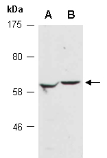 CDC23 Antibody Western (Abiocode)