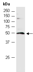 MMP10 Antibody Western (Abiocode)