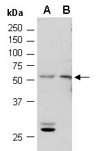 IRF3 Antibody Western (Abiocode)