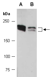 PIK3C2A Antibody Western (Abiocode)