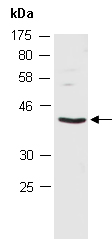 CSNK2A2 Antibody Western (Abiocode)