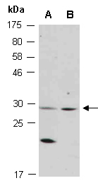 ASCL1 Antibody Western (Abiocode)