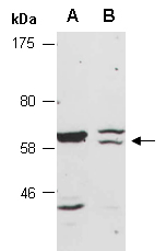 ZC3H12D Antibody Western (Abiocode)