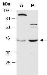 SRSF6 Antibody Western (Abiocode)