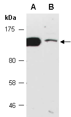 HIP1 Antibody Western (Abiocode)