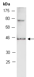 HOXA13 Antibody Western (Abiocode)