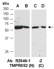 TMPRSS2 Antibody Western (Abiocode)