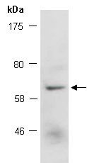 ZBTB7C Antibody Western (Abiocode)