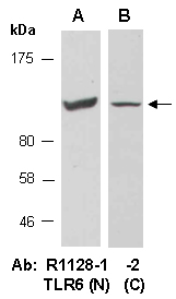 TLR6 Antibody Western (Abiocode)