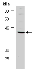 MAGEB6 Antibody Western (Abiocode)