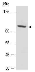 ZNF711 Antibody Western (Abiocode)