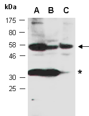CRLF2 Antibody Western (Abiocode)