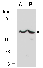 IL6ST Antibody Western (Abiocode)