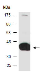 PRKAR1A Antibody Western (Abiocode)