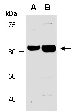 ZBTB16 Antibody Western (Abiocode)