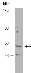 TRMT2B Antibody Western (Abiocode)