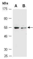MESP2 Antibody Western (Abiocode)