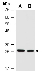 SNRPN Antibody Western (Abiocode)
