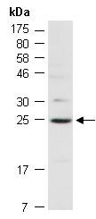 HLA-DPB1 Antibody Western, Abiocode