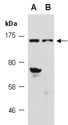 ZNF804A Antibody Western (Abiocode)