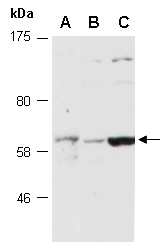 GLP2R Antibody Western (Abiocode)