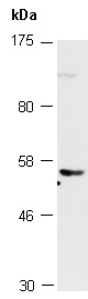 SEPT4 Antibody Western (Abiocode)