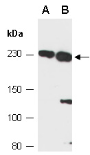 PRPF8 Antibody Western (Abiocode)