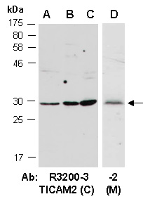 TICAM2 Antibody Western (Abiocode)