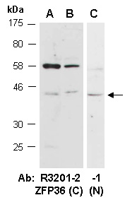 ZFP36 Antibody Western (Abiocode)