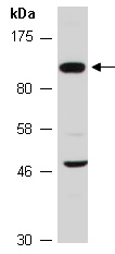 AMPD2 Antibody Western (Abiocode)