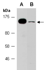 ZNF423 Antibody Western (Abiocode)