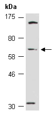 A1BG Antibody Western (Abiocode)