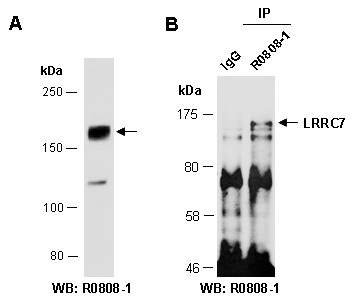 LRRC7 Western IP Antibody (Abiocode)