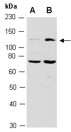 KANSL1 Antibody Western (Abiocode)