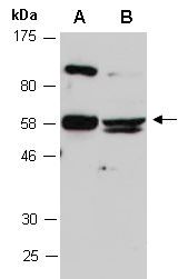 TNFRSF11B Antibody Western (Abiocode)