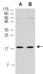 LBH Antibody Western (Abiocode)