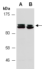 HERC4 Antibody Western (Abiocode)