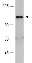 ITGA5 Antibody Western (Abiocode)
