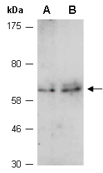 MMP24 Antibody Western (Abiocode)
