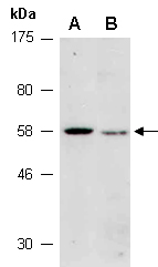 ZBTB12 Antibody Western (Abiocode)