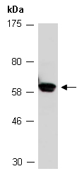 CDK19 Antibody Western (Abiocode)