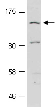 AMBRA1 Antibody Western (Abiocode)