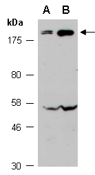 ABCB1 Antibody Western (Abiocode)
